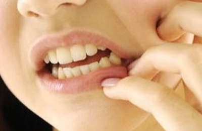 突發(fā)性、自發(fā)性的劇烈牙疼