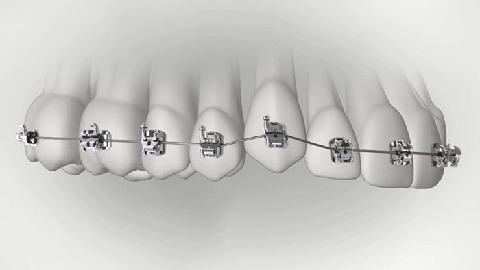 承德市哪家口腔醫(yī)院口腔正畸做得好？惟德口腔醫(yī)院來告訴您